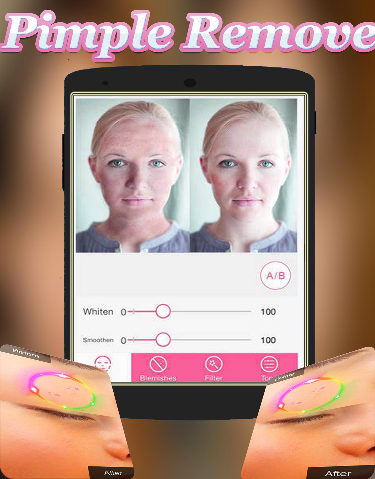 Face Blemishes Cleaner & Face Pimple Removal