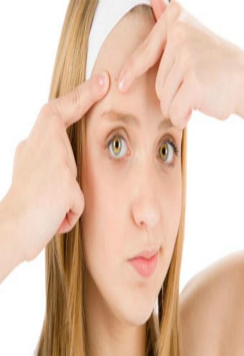 facial acne