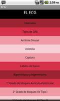 Electrocardiograma ECG Tipos