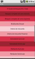 Electrocardiograma ECG Tipos