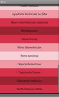 Electrocardiograma ECG Tipos