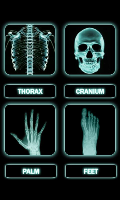 Ultrasound X Ray Scanner